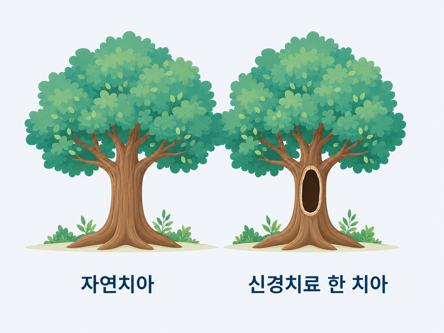 신경치료 한 치아를 속 빈 고목에 비유한 그림, 속은 비었어도 단단히 제 역할을 한다는 설명.png