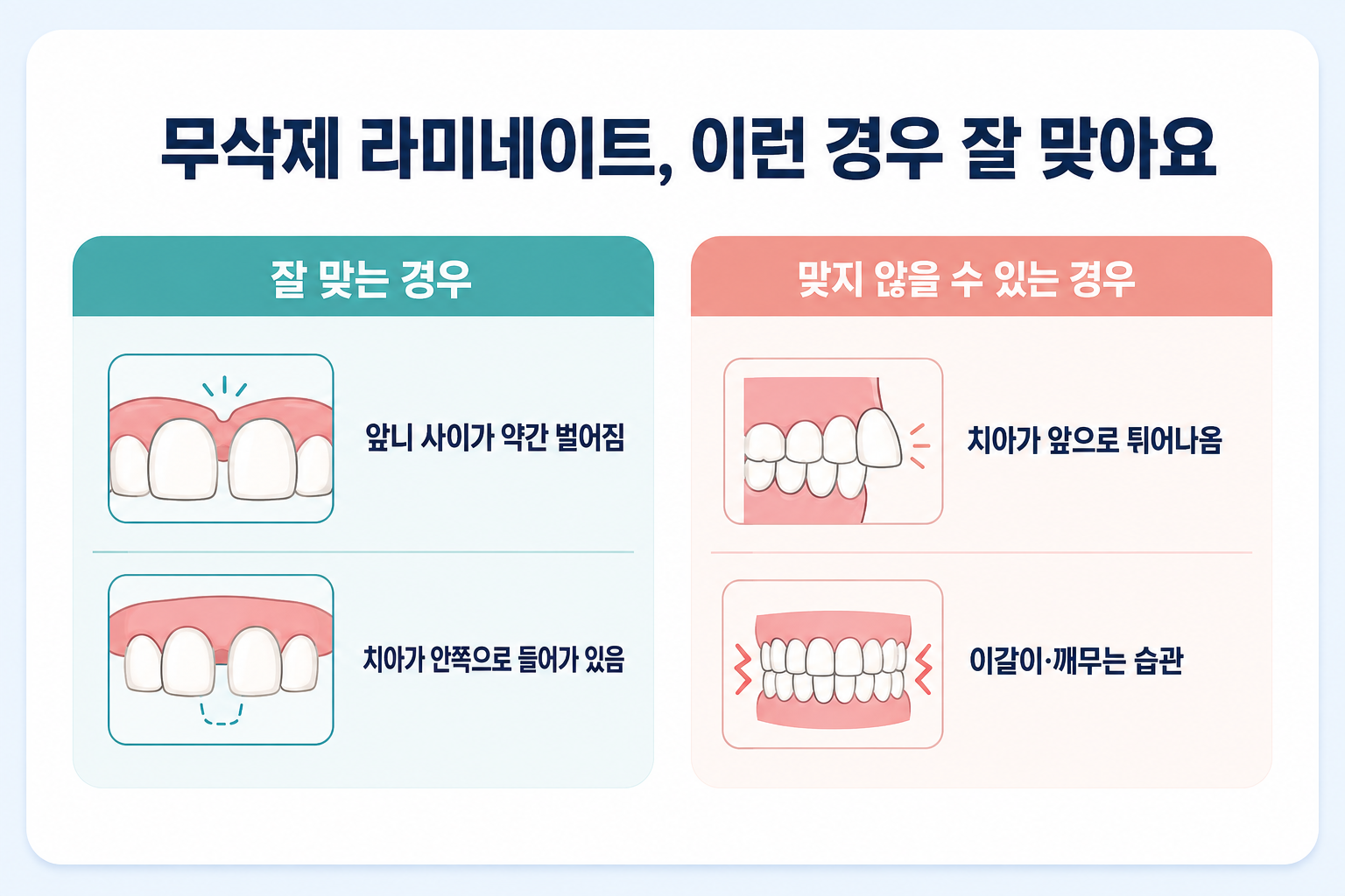 무삭제 라미네이트가 잘 맞는 경우(벌어짐, 안쪽으로 들어간 치아)와 맞지 않는 경우(튀어나온 치아, 이갈이)를 정리한 그림.png
