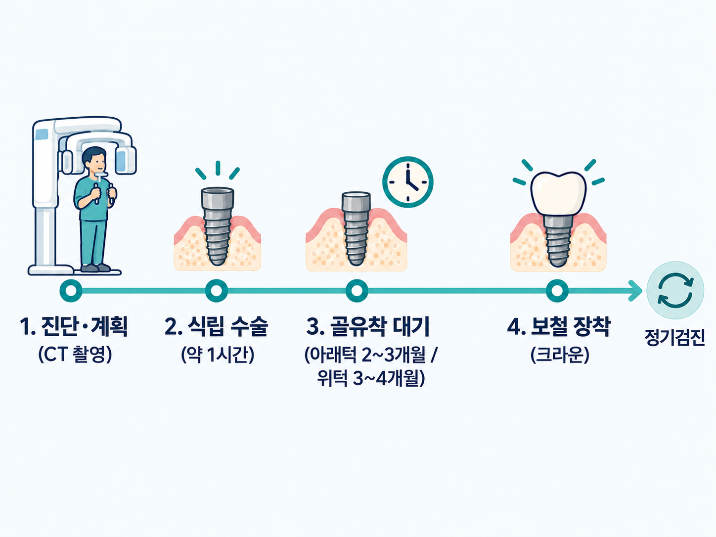 임플란트 치료 과정 타임라인 - 진단, 식립 수술, 골유착 대기, 보철 장착 4단계와 단계별 기간.png