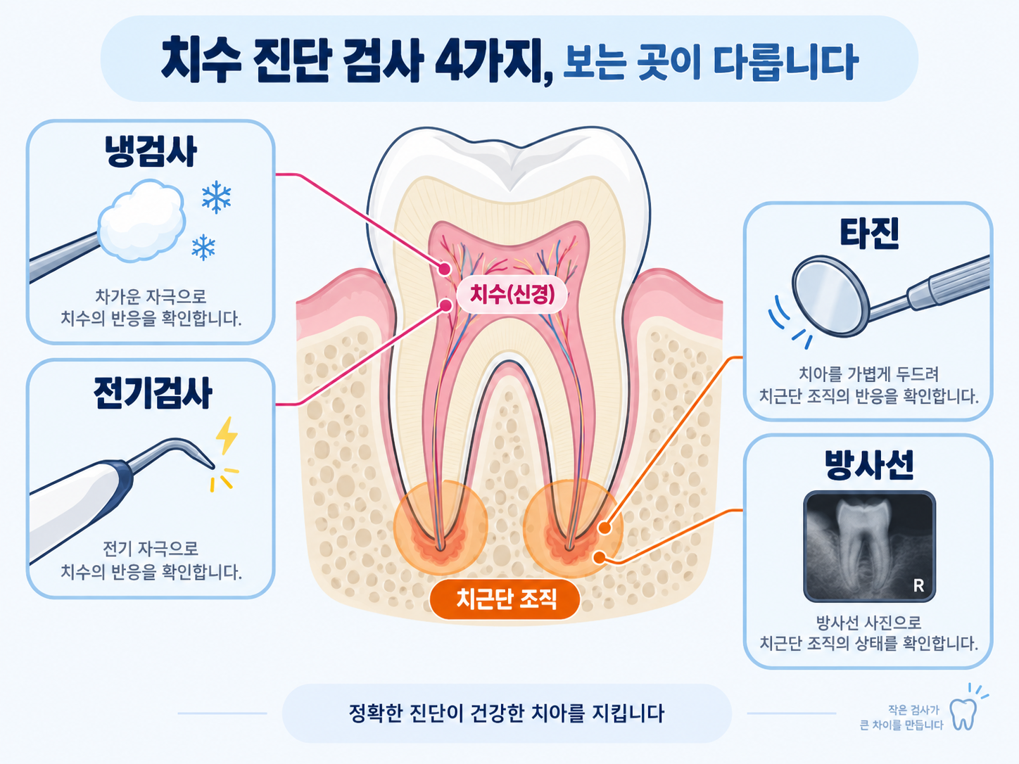 마곡베스트치과 치수 진단 검사 냉검사 전기검사 타진 방사선과 치수 치근단 진단 부위.png