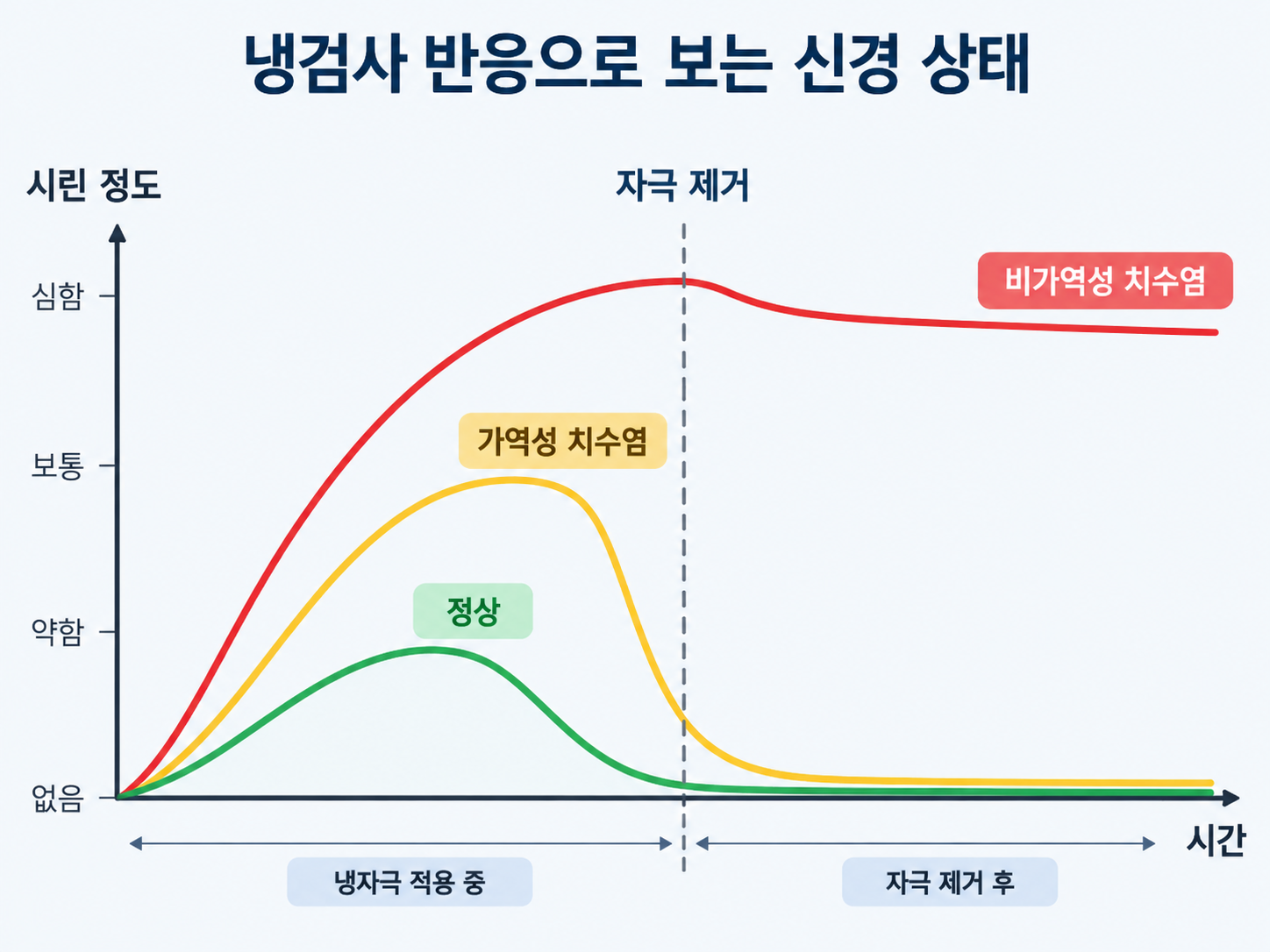 냉검사 반응 지속 시간에 따른 정상 가역성 비가역성 치수염 비교.png